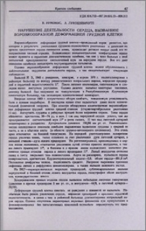 Нарушение деятельности сердца, вызванное воронкообразной деформацией грудной клетки