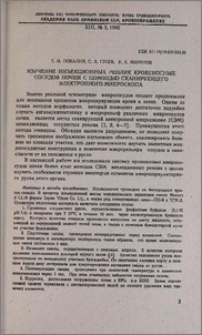 Изучение инъекционных реплик кровеносных сосудов почки с помощью сканирующего электронного микроскопа