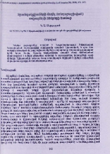 Տրանզակցիաների մոդել (տեղաբաշխված) տվյալների հենքերի համար