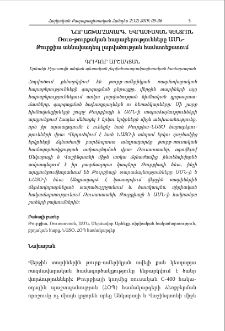 Ռուս-թուրքական հարաբերությունները ԱՄՆ-Թուրքիա աննախադեպ լարվածության համատեքստում